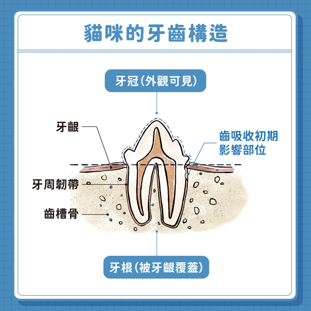 Tooth Resorption 04